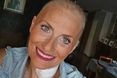 Isabella Mangialardi, prima paziente con Stiff-Person Syndrome a sottoporsi a un trapianto di midollo
