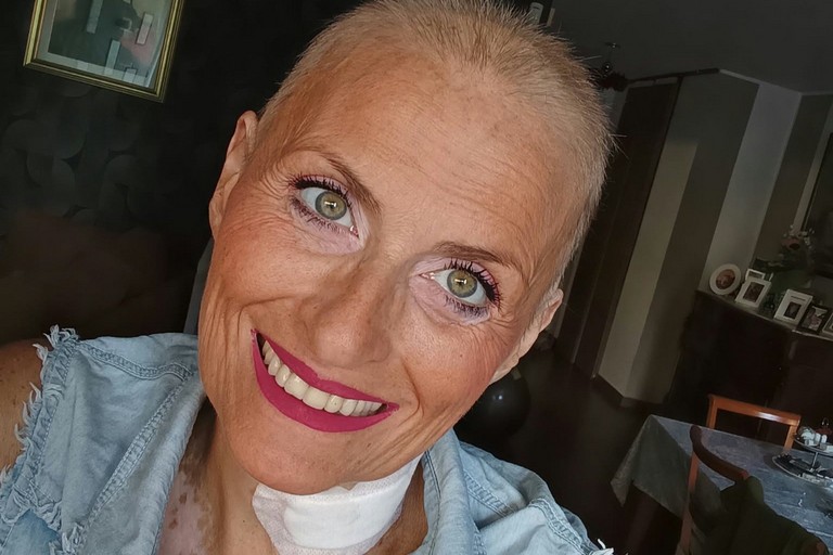 La modugnese Isabella Mangialardi: sarà la prima trapiantata affetta dalla Stiff-Person Syndrome